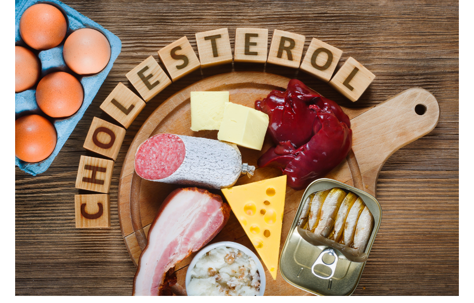 How to Manage and Monitor Your Cholesterol